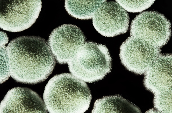 Close-up of mold spores